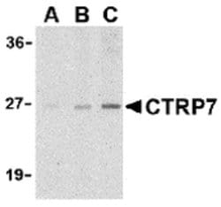 Invitrogen CTRP7 Polyclonal Antibody 100 &mu;g | Buy Online | Invitrogen&trade; | Fisher Scientific