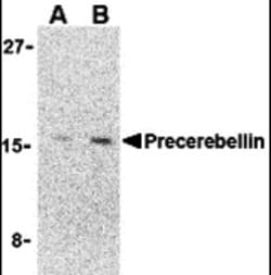 Invitrogen Precerebellin Polyclonal Antibody 100 μg; Unconjugated:Antibodies,