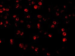 Invitrogen Beclin 1 Polyclonal Antibody 100 μg; Unconjugated:Antibodies,