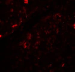 Beclin 1 Polyclonal Antibody, Invitrogen 100 &mu;g; Unconjugated:Antibodies