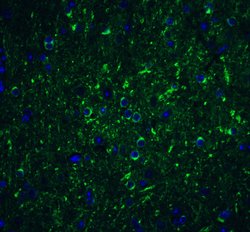 Beclin 1 Polyclonal Antibody, Invitrogen 100 &mu;g; Unconjugated:Antibodies
