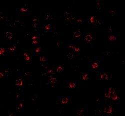 Invitrogen ATG7 Polyclonal Antibody 100 &mu;g | Buy Online | Invitrogen&trade; | Fisher Scientific