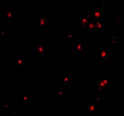 Invitrogen ATG7 Polyclonal Antibody 100 &mu;g; Unconjugated:Antibodies,