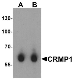 Invitrogen CRMP1 Polyclonal Antibody 100 &mu;g; Unconjugated:Antibodies,