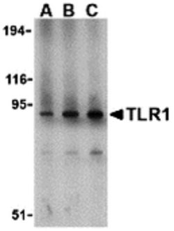 Invitrogen TLR1 Polyclonal Antibody 100 &mu;g | Buy Online | Invitrogen&trade; | Fisher Scientific