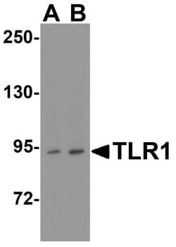 Invitrogen TLR1 Polyclonal Antibody 100 &mu;g; Unconjugated:Antibodies