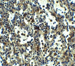 Invitrogen TLR3 Polyclonal Antibody 100 &mu;g; Unconjugated:Antibodies,