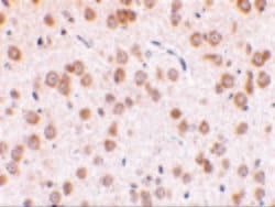Invitrogen TLR5 Polyclonal Antibody 100 &mu;g | Buy Online | Invitrogen&trade; | Fisher Scientific