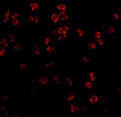 Invitrogen TLR5 Polyclonal Antibody 100 μg; Unconjugated:Antibodies,
