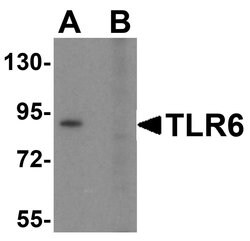 Invitrogen TLR6 Polyclonal Antibody 100 &mu;g; Unconjugated:Antibodies,