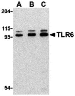Invitrogen TLR6 Polyclonal Antibody 100 &mu;g | Buy Online | Invitrogen&trade; | Fisher Scientific
