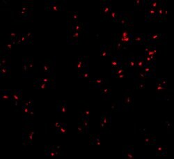 Invitrogen IRE1 alpha Polyclonal Antibody 100 &mu;g; Unconjugated:Antibodies,