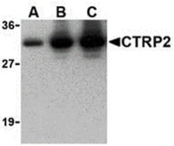 Invitrogen CTRP2 Polyclonal Antibody 100 &mu;g; Unconjugated:Antibodies,