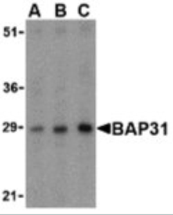 Invitrogen BAP31 Polyclonal Antibody 100 &mu;g; Unconjugated:Antibodies,