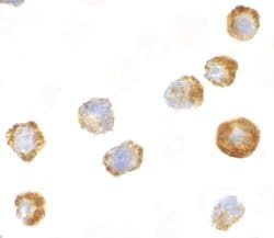 Invitrogen ASK1 Polyclonal Antibody 100 &mu;g; Unconjugated:Antibodies,