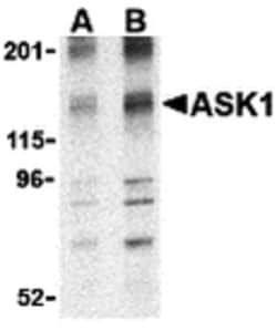 Invitrogen ASK1 Polyclonal Antibody 100 &mu;g; Unconjugated:Antibodies,