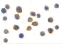 Invitrogen TLR9 Polyclonal Antibody 100 &mu;g; Unconjugated:Antibodies,