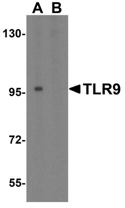 Invitrogen TLR9 Polyclonal Antibody 100 &mu;g; Unconjugated:Antibodies,