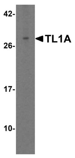 Invitrogen TL1A Polyclonal Antibody 100 &mu;g | Buy Online | Invitrogen&trade; | Fisher Scientific
