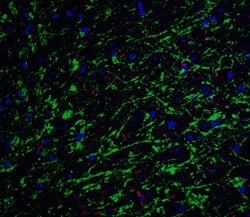 Invitrogen Apolipoprotein J Polyclonal Antibody 100 &mu;g; Unconjugated:Antibodies,
