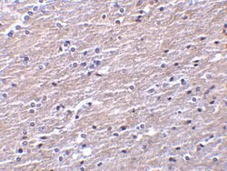 Invitrogen Apolipoprotein J Polyclonal Antibody 100 &mu;g; Unconjugated:Antibodies,