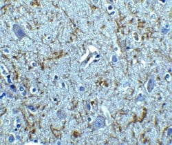 Invitrogen Apolipoprotein J Polyclonal Antibody 100 &mu;g; Unconjugated:Antibodies,
