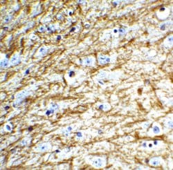 Invitrogen Apolipoprotein J Polyclonal Antibody 100 &mu;g; Unconjugated:Antibodies,