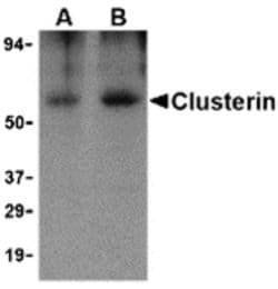Invitrogen Apolipoprotein J Polyclonal Antibody 100 &mu;g; Unconjugated:Antibodies,