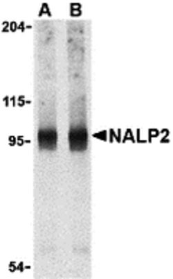 Invitrogen NALP2 Polyclonal Antibody 100 &mu;g | Buy Online | Invitrogen&trade; | Fisher Scientific