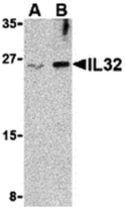 Invitrogen IL-32 Polyclonal Antibody 100 &mu;g | Buy Online | Invitrogen&trade; | Fisher Scientific