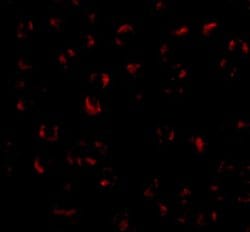 Invitrogen BMI-1 Polyclonal Antibody 100 &mu;g; Unconjugated:Antibodies,