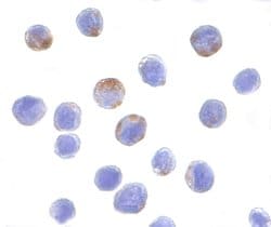 Invitrogen DDX3 Polyclonal Antibody 100 &mu;g; Unconjugated:Antibodies,