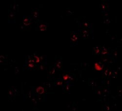 Invitrogen DDX3 Polyclonal Antibody 100 &mu;g; Unconjugated:Antibodies,