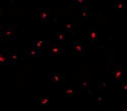 PAK6 Polyclonal Antibody, Invitrogen 100 &mu;g; Unconjugated:Antibodies