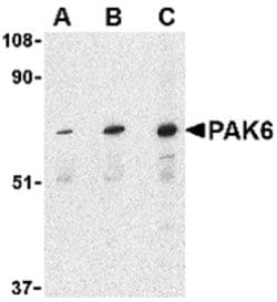 PAK6 Polyclonal Antibody, Invitrogen 100 &mu;g; Unconjugated:Antibodies