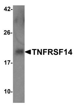 Invitrogen TNFRSF14 Polyclonal Antibody 100 &mu;g | Buy Online | Invitrogen&trade; | Fisher Scientific
