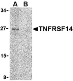 Invitrogen TNFRSF14 Polyclonal Antibody 100 &mu;g | Buy Online | Invitrogen&trade; | Fisher Scientific