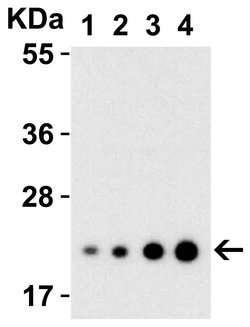 Invitrogen IL-23 p19 Polyclonal Antibody 100 &mu;g | Buy Online | Invitrogen&trade; | Fisher Scientific