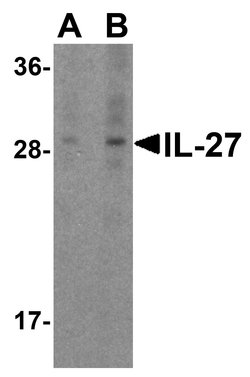 Invitrogen IL-27 p28 Polyclonal Antibody 100 &mu;g | Buy Online | Invitrogen&trade; | Fisher Scientific