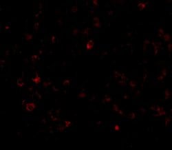 Invitrogen AIM Polyclonal Antibody 100 &mu;g; Unconjugated:Antibodies,