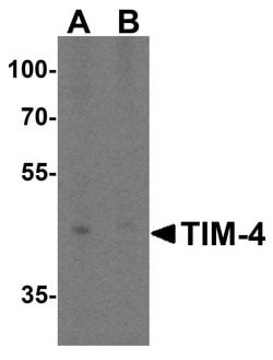 Invitrogen TIMD4 Polyclonal Antibody 100 &mu;g | Buy Online | Invitrogen&trade; | Fisher Scientific