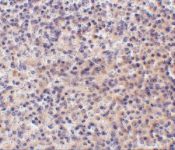 Invitrogen CD180 Polyclonal Antibody 100 &mu;g | Buy Online | Invitrogen&trade; | Fisher Scientific