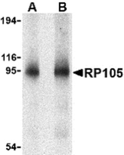 Invitrogen CD180 Polyclonal Antibody 100 &mu;g | Buy Online | Invitrogen&trade; | Fisher Scientific