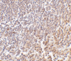 Invitrogen MD-1 Polyclonal Antibody 100 &mu;g | Buy Online | Invitrogen&trade; | Fisher Scientific
