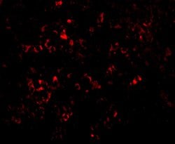 Invitrogen PAK2 Polyclonal Antibody 100 μg; Unconjugated:Antibodies,