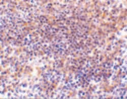 Invitrogen PAK2 Polyclonal Antibody 100 μg; Unconjugated:Antibodies,