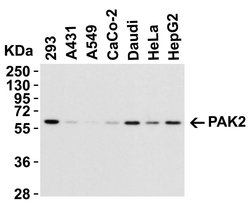 Invitrogen PAK2 Polyclonal Antibody 100 μg; Unconjugated:Antibodies,