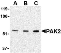 Invitrogen PAK2 Polyclonal Antibody 100 μg; Unconjugated:Antibodies,