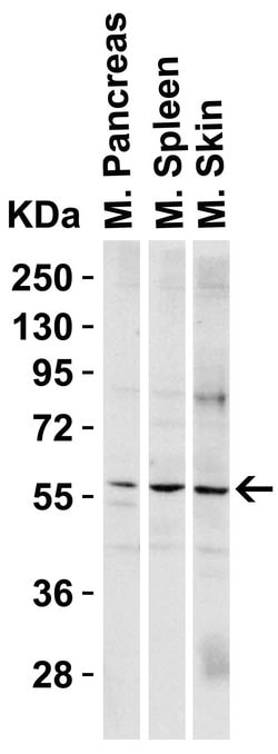 Invitrogen PAK2 Polyclonal Antibody 100 μg; Unconjugated:Antibodies,