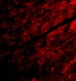Invitrogen TRPC3 Polyclonal Antibody 100 &mu;g; Unconjugated:Antibodies,